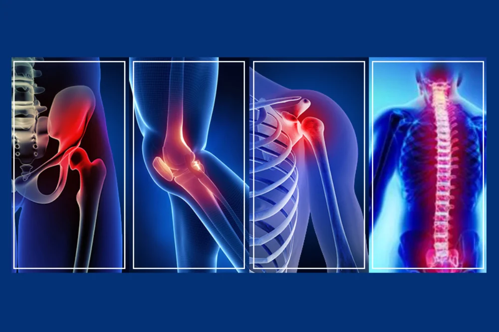 Orthopedic Treatments